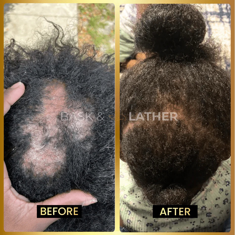 JUMBO Scalp Stimulator